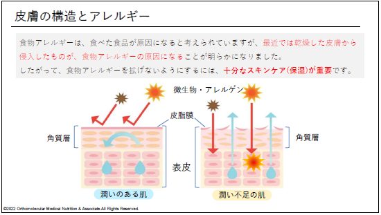 皮膚の構造とアレルギーについての説明図